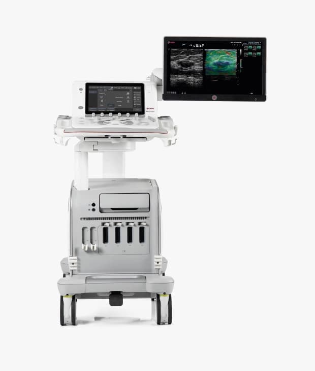 Esaote Launches AI Cardiac Ultrasound System at ESC 2025